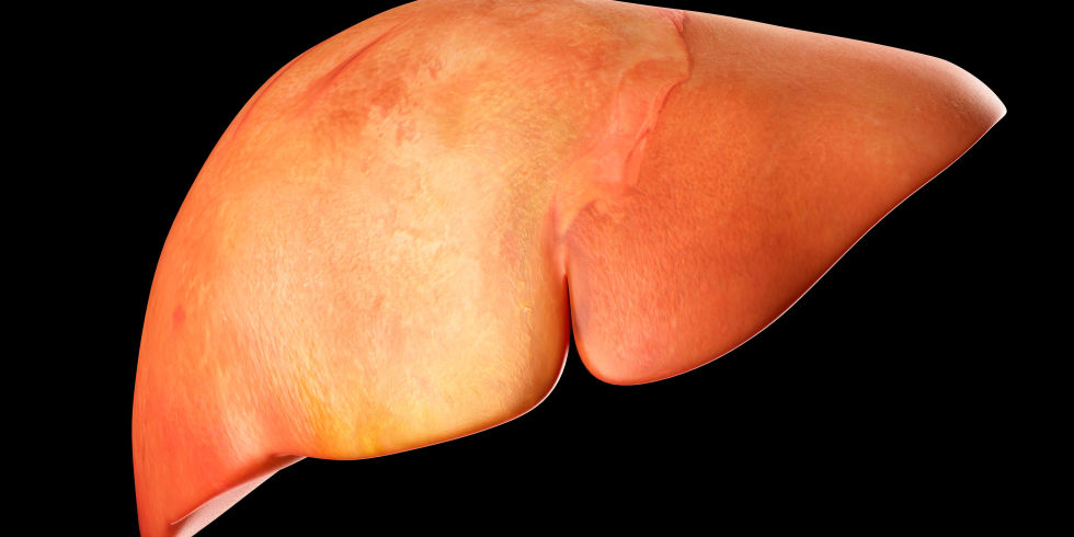 Non Alcoholic Fatty Liver Disease